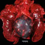 Anatomical close-up of human heart