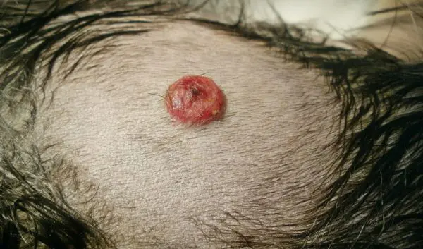 hemangiosarcoma-risk-factors-600x353_orig